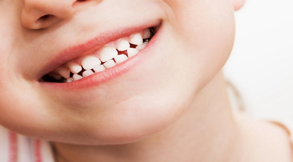 HAPPY BRACES