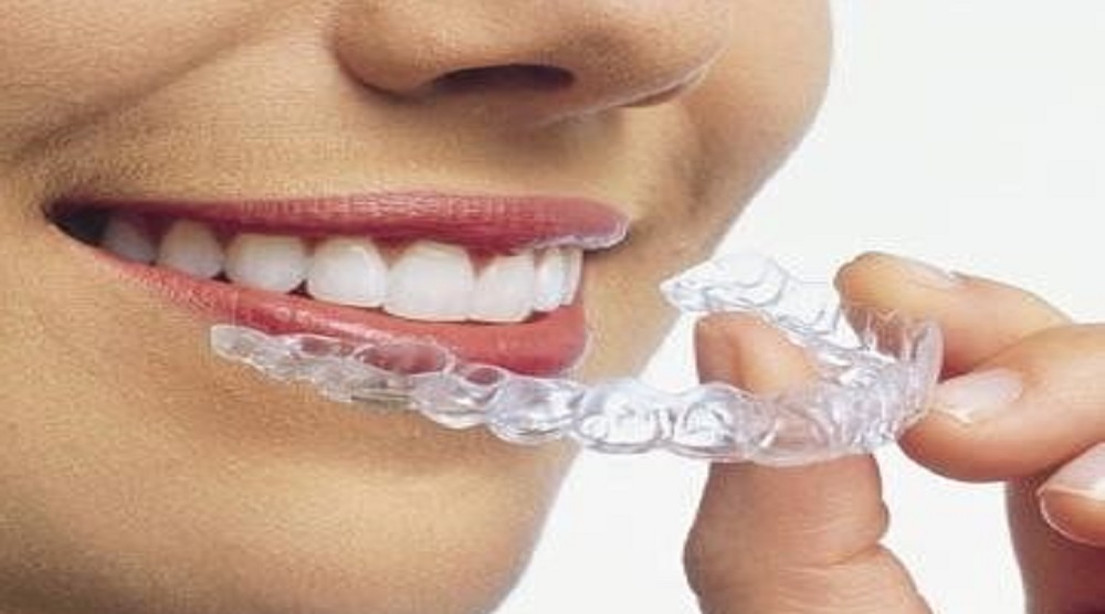  HAPPY BRACES
